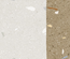 Croccante Granola Nuez - Carrelage aspect terrazzo 20x20 cm